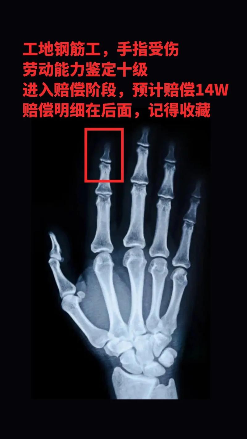 看手机摔倒索赔6万;看手机摔倒索赔6万元