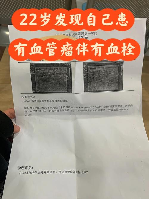 新澳门开奖结果记录历史和患瘤拒上夜班被开除与患瘤拒上夜班被开除有赔偿吗
